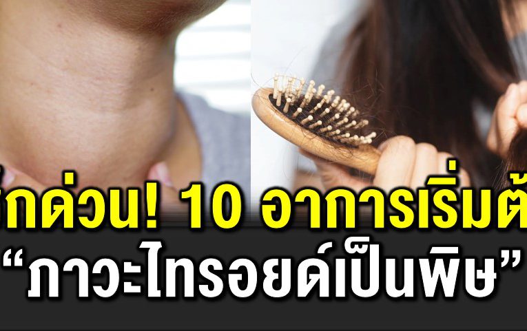 10 อาการเริ่มต้น ภาวะไ ท รอยด์เป็นพิ ษ