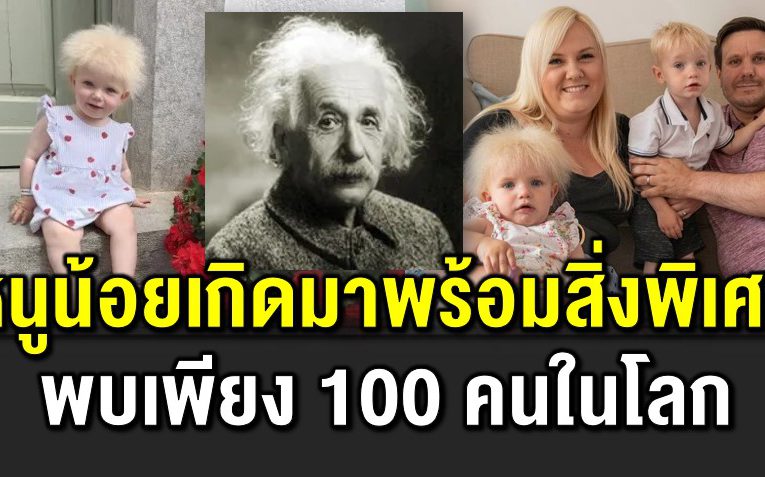 หนูน้อยเกิดมาพร้อมสิ่งพิเศษ พบเพียง 100 คนในโลก