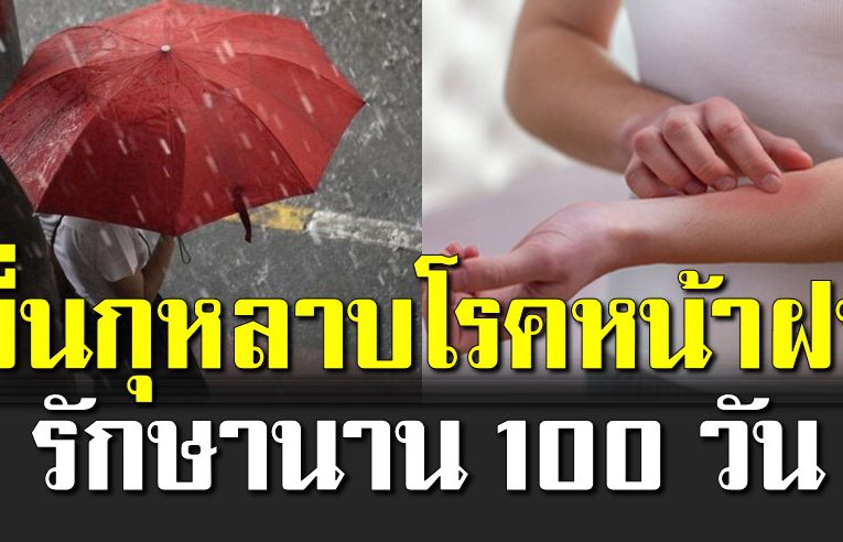 หน้าฝน ผื่นกุหลาบ รักษานาน 100 วัน